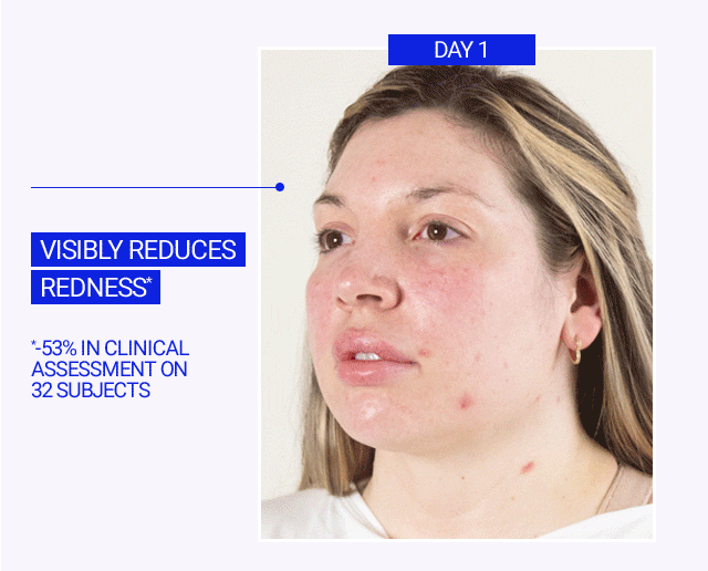 Visibly reduces redness*