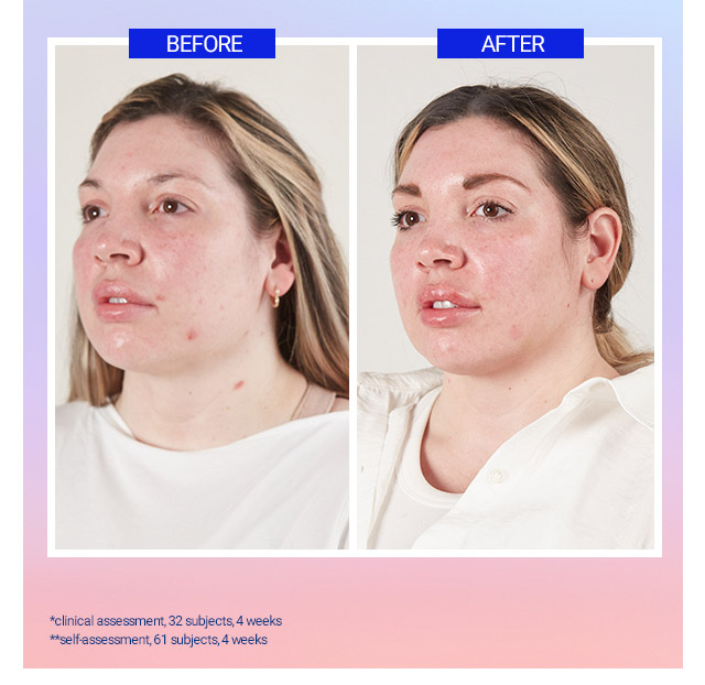 Dermatologist tested FOR sensitive skin*