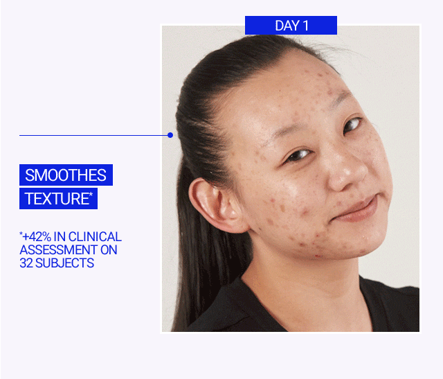Smoothes texture*